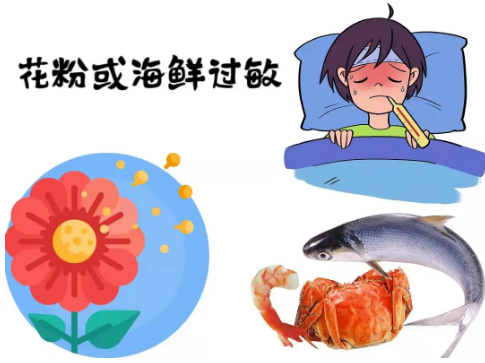 海鲜过敏