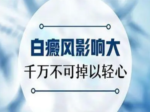 白癜风危害 白癜风危害